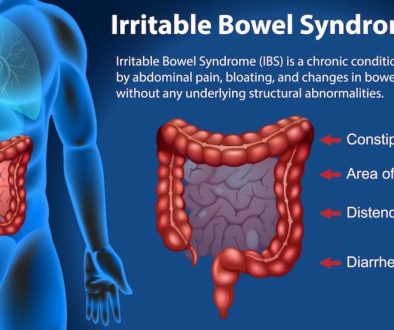 Irritable Bowel Syndrome (IBS) Infographic